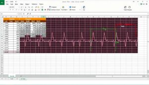 EKG Diagramm Excel Vorlage hier kostenlos downloaden